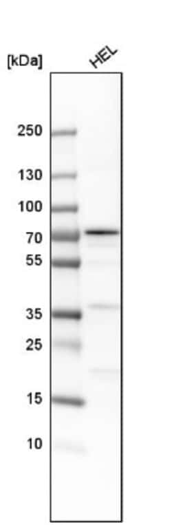 12-Lipoxygenase Antibody, Novus Biologicals 0.1mL; Unlabeled:Antibodies,